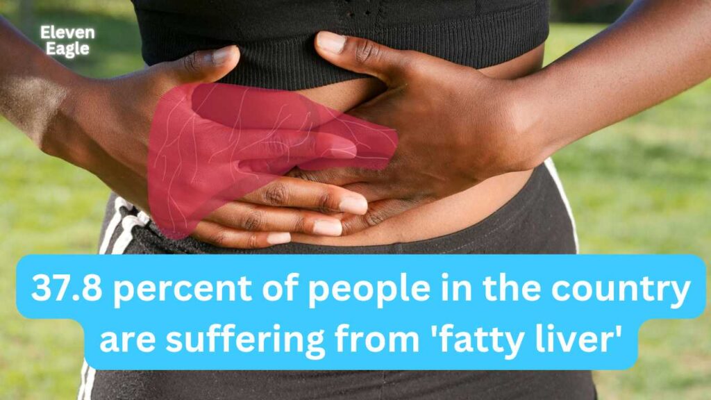 37.8 percent of people in the country are suffering from 'fatty liver'; The prevalence is increasing due to obesity